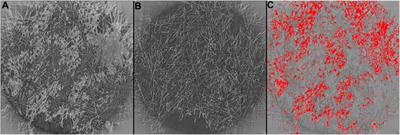 Visualizing Water Desaturation in Frozen Gas Diffusion Layers With Flow Field Segmentation via Synchrotron X-Ray Radiography